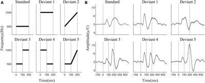 Contribution of inter-trial phase coherence at theta, alpha, and beta frequencies in auditory change detection